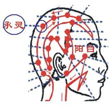 承靈穴→治療面部痙攣