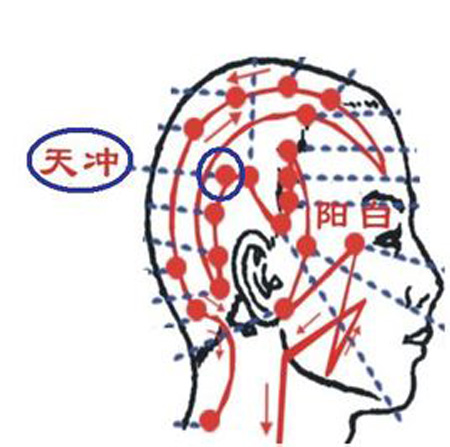 天沖穴→治頭痛、齒痛