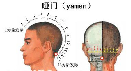 啞門穴→治音啞、頭痛