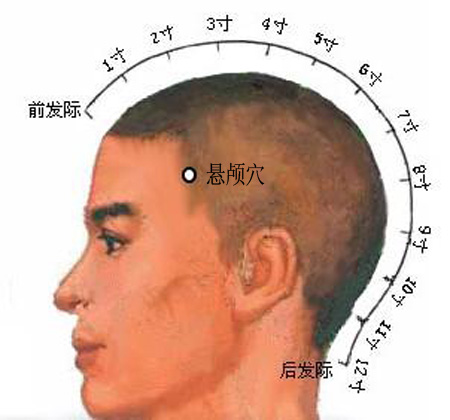 懸顱穴→治偏頭痛、面腫