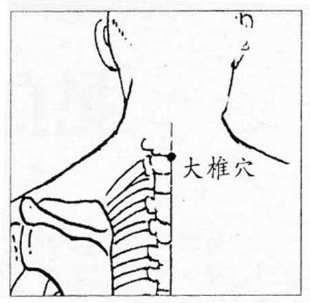 大椎穴→清熱解表