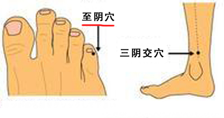 至陰穴→治頭痛、目痛