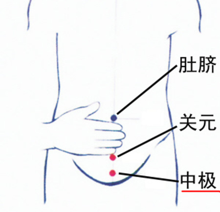 中極穴：補腎培元，調(diào)治陰挺、不孕