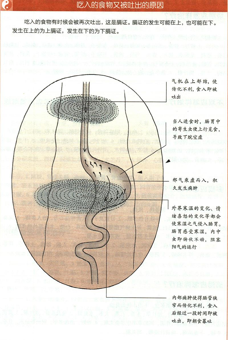 嘔吐應(yīng)怎樣治療？